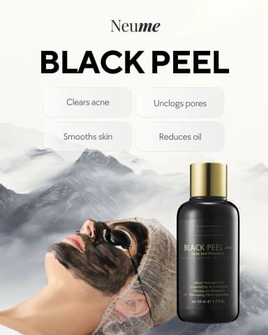 Black Peel