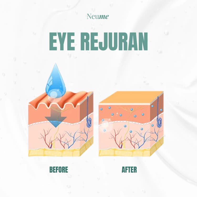 Eye Rejuran