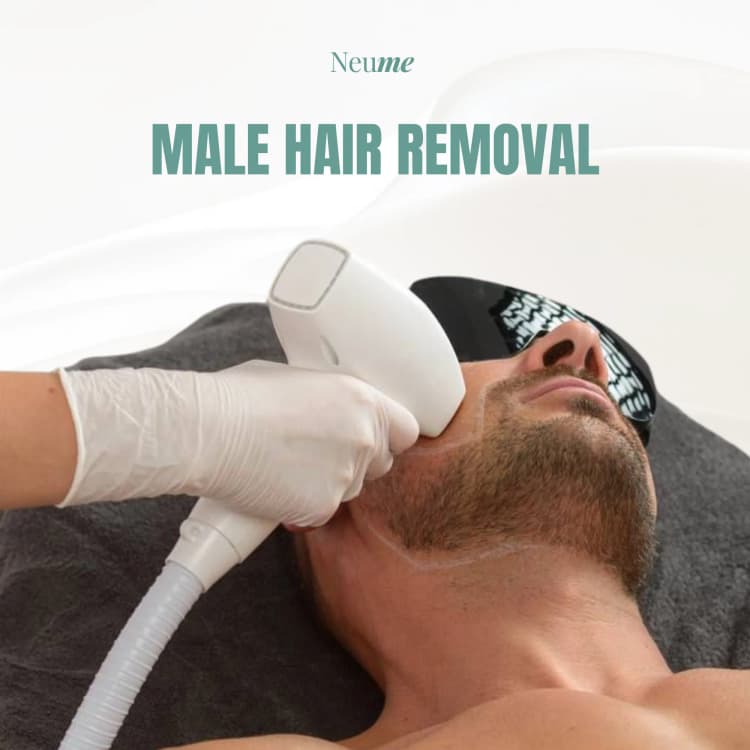 Male Laser Hair Removal