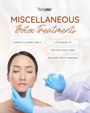 Other Botox Treatments