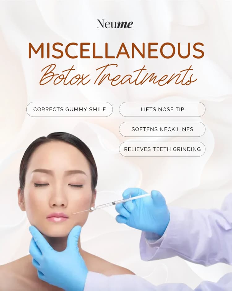 Other Botox Treatments