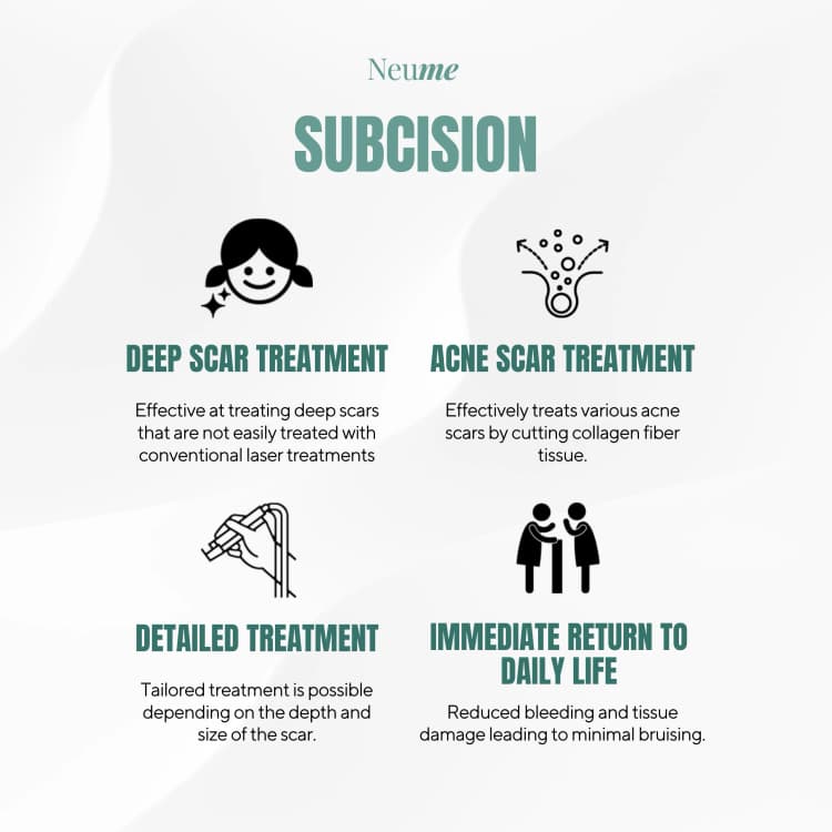 Subcision