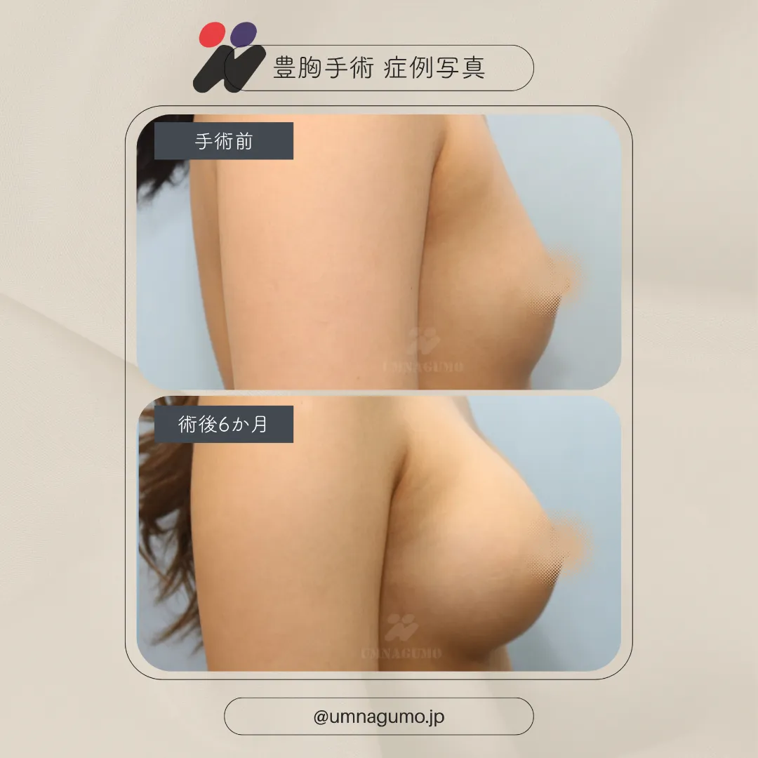 施術後