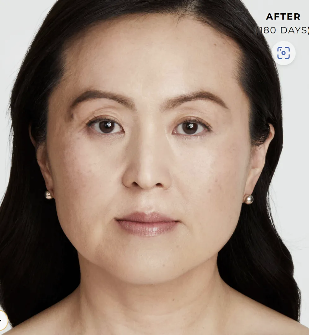 治疗后