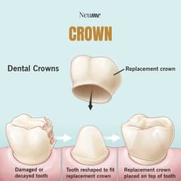 Crown