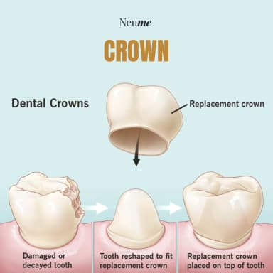 Crown