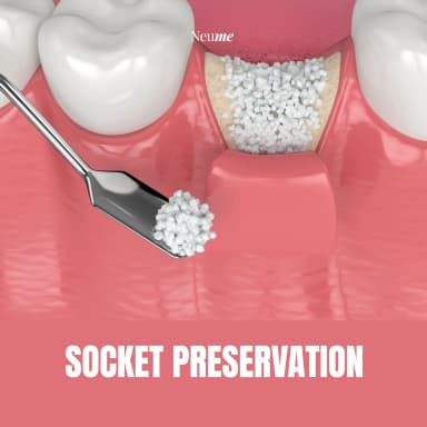 Socket Preservation