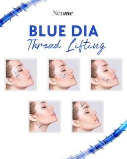 ブルーダイヤスレッドリフティング