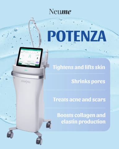 Potenza Laser