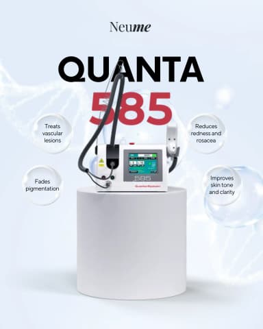 Quanta 585 激光