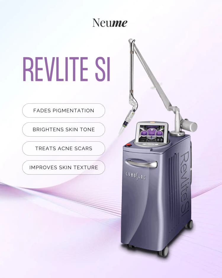 REVlite SI