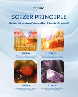 https://neume-media-prod.s3.amazonaws.com/date=2025-07-29/1753776990055-3_Types_of_Cartridges_For_Delicate_Energy_Delivery_3_Types_of_Cartridges_delicately_deliver_energy_to_various_skin_layers_upper_dermis_dermis_fascia_SMAS_layer_forming_a_coagulation_zone_and_8_.webp