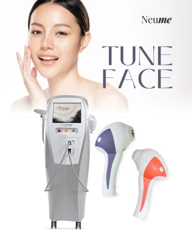 チューンフェイス